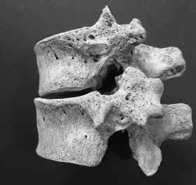 3: рудиментарно XII лево ребро Figure 5. Kaponja, grave 46.