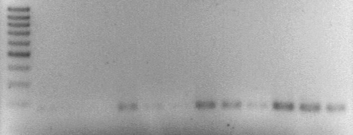 Eredmények rek olvadáspontja alapján az 50 C-tól 65 C-ig terjedő hőmérséklet tartomány alkalmazhatóságát gradiens PCR-rel vizsgálatuk.