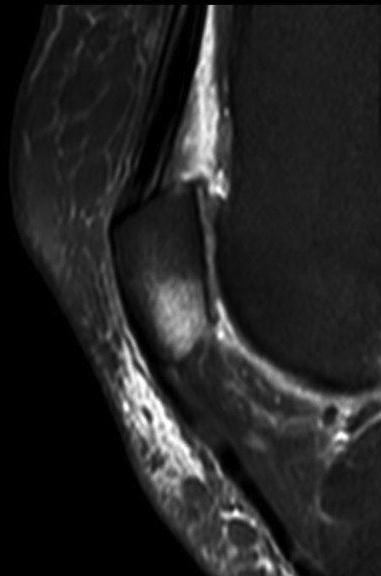 2017/1-2 OSTEOLOGIAI KÖZLEMÉNYEK 17 7. kép.