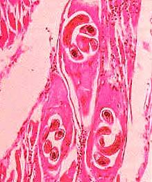 Nematoda Trichinella