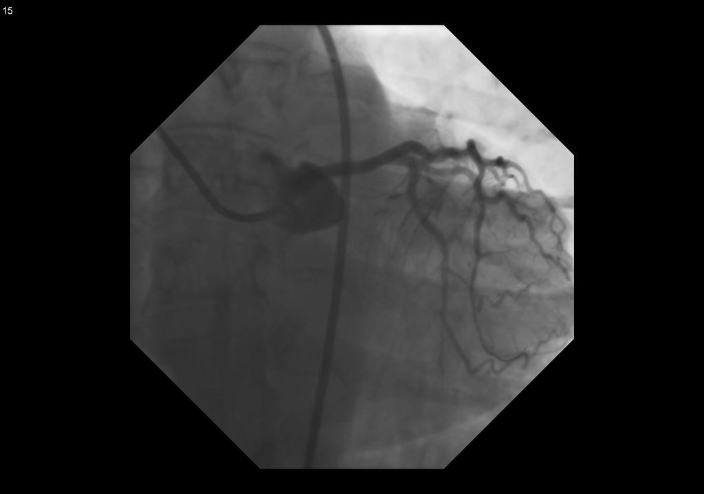 rendelkező stent Köszönöm a