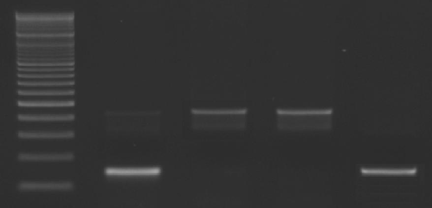 Molekuláris biológiai diagnosztika kétes esetekben 500bp 400bp 300bp 200bp 100bp GH -