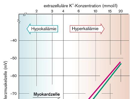2 mmol/l) Hiperkalémia >5.5 mmol/l (>6.5 mm mmol/l) Hipokalémia <3.