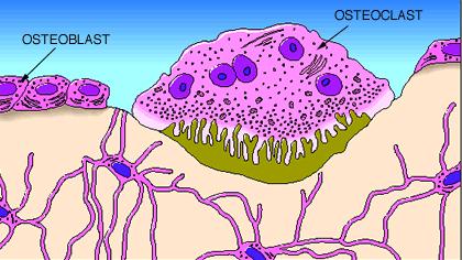 sejtek, savat és enzimeket szekretálva feloldják és bekebelezik a csontszövetet Csont remodeling ciklus: