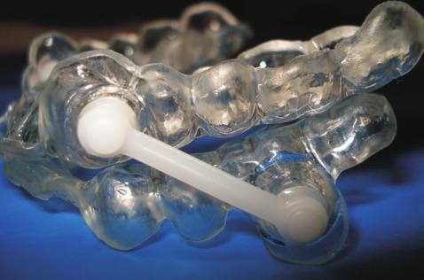 Medicina dentar` [i tratamentul apneei [i al snoringului Belengeanu D., Ilie[ D., Matekovits Gh.