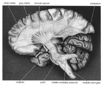 Az agy belső pályáinak rostozata white matter gray matter internal capsule cerebellum midbrain pons middle
