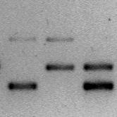 Eredmények 5 EREDMÉNYEK 5.1 A 120 bp duplikáció új alléljának azonosítása a DRD4 gén promoterében Munkánk során a 120 bp duplikáció egy új allélját azonosítottuk.