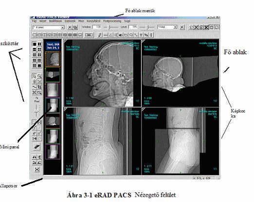 A fejezet alábbi szekciója információval szolgál az erad PACS viewer felépítéséről és komponenseiről. 3.1 Eszköztár / Toolbars Az erad PACS viewer-ben találkozhatunk eszköztárakkal.