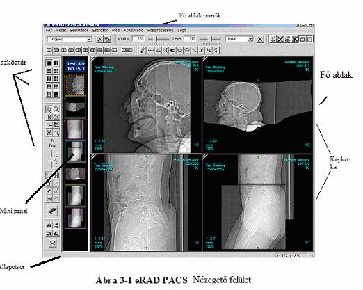 ERAD PACS TM VIEWER KÉZIKÖNYV. 6.0 Verzió. Copyright 2007 erad, Inc. Az  összes jog fenntartva. - PDF Ingyenes letöltés