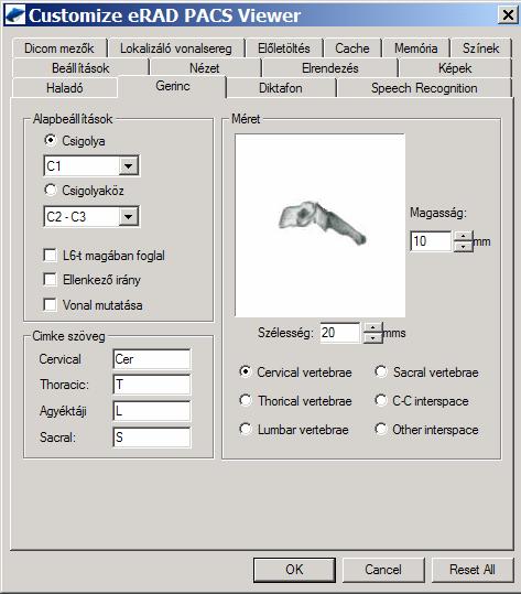 4.1.12 GERINC ESZKÖZ BEÁLLÍÁTSAI / SPINE TOOL SETTINGS erad PACS A gerinc eszköz beállításai definiálják az alapért. beállításokat a gerinccímkéző annotációs eszközhöz.