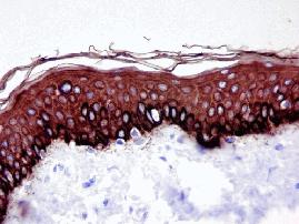 +++ Tris/EDTA ph 9* ++++ Javasolt! - Morgan et al.