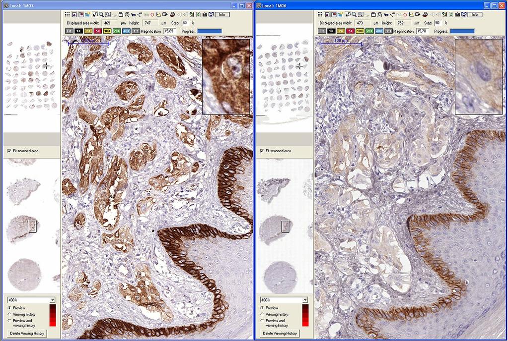 Immunhisztokémia Erősített polimer