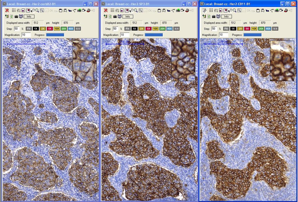 Her-2 IHC - Primer