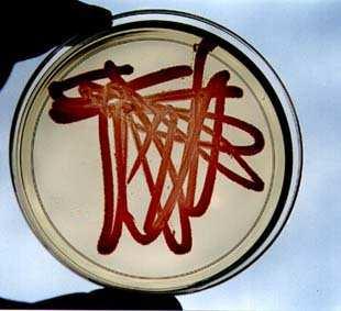 diphtheriae, B.