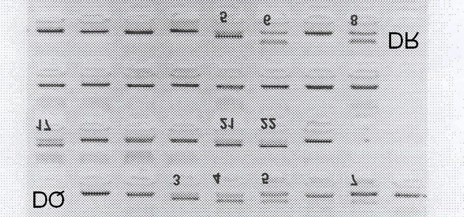 4.2.1. Ábra. HLA meghatározás elektroforetikus képe.