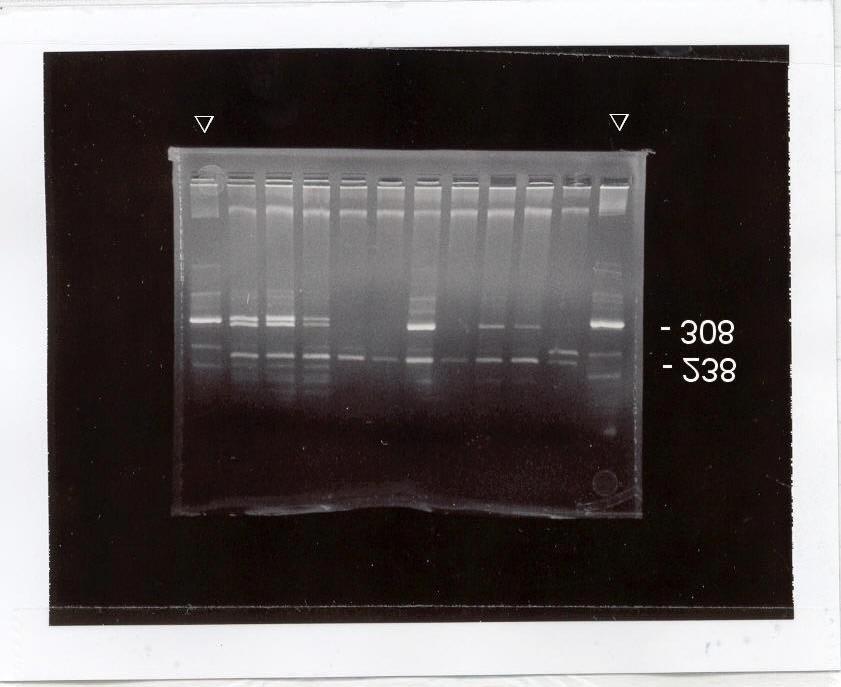 4.4.2. ábra. A TNF alfa promoter polimorfizmus vizsgálata, PCR-RFLP és emésztés után a termékeket agaróz gélen futtattuk. Két oldalon a nyilak az emésztetlen PCR terméket mutatják.