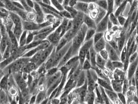 sejtvonalak: CHO: Chinese hamster ovary COS: afrikai zöld majom veséjéből, SV40 vírussal