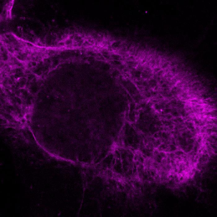 Példa: Vimentin fehérje fluoreszcens jelölése géntechnológiai úton 4.