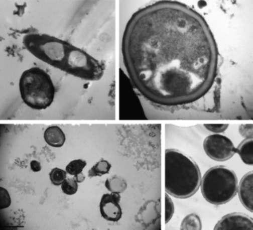 40 4. USE OF NATURAL PRODUCTS AGAINST RESISTANT CANDIDAS leakage of intracellular compounds and inhibit respiration in bacteria and yeasts, particularly in Candida, suggesting adverse effects on