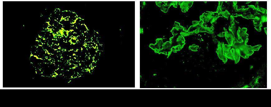 GN-Pathogenesis Granuláris ID