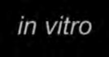 őssejt Közös Ly precursor T/NK