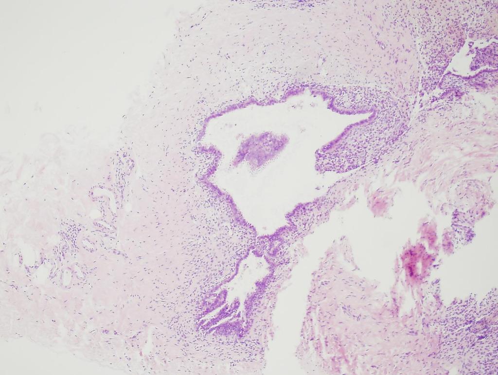 Peritoneal