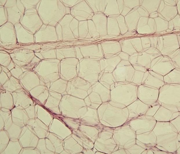 Zsírszövet tápanyagforgalma Adipocyták: subcutan, visceralis, pericardialis, perirenalis Barna vs fehér zsírszövet thermogenezis vs zsírraktár Trigliceridek energiaraktár