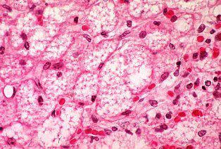 lipolízis (hormonszenzitív lipáz NA, A, glukagon) Máj tápanyagforgalma Vena portae, a. hepatica; v.