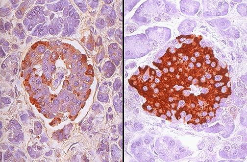Pancreaticus polipeptid (PP) pancreas exocrin működését