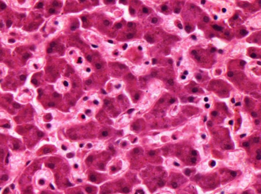46. Máj (HE) 50x hepatocyták