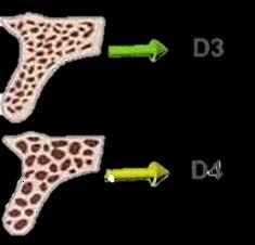 Anterior mandibula >1250 HU D2