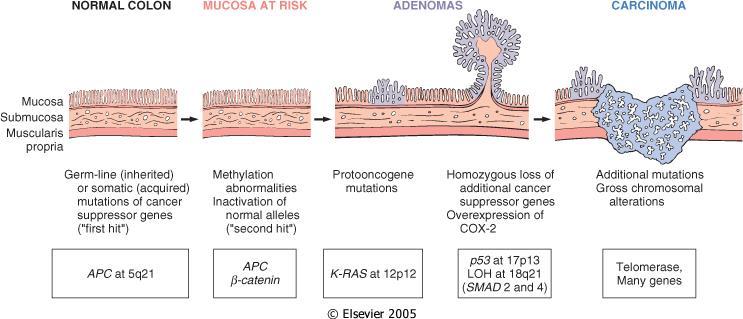 Adenoma