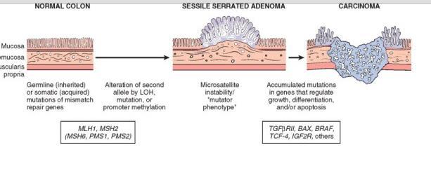 Adenoma