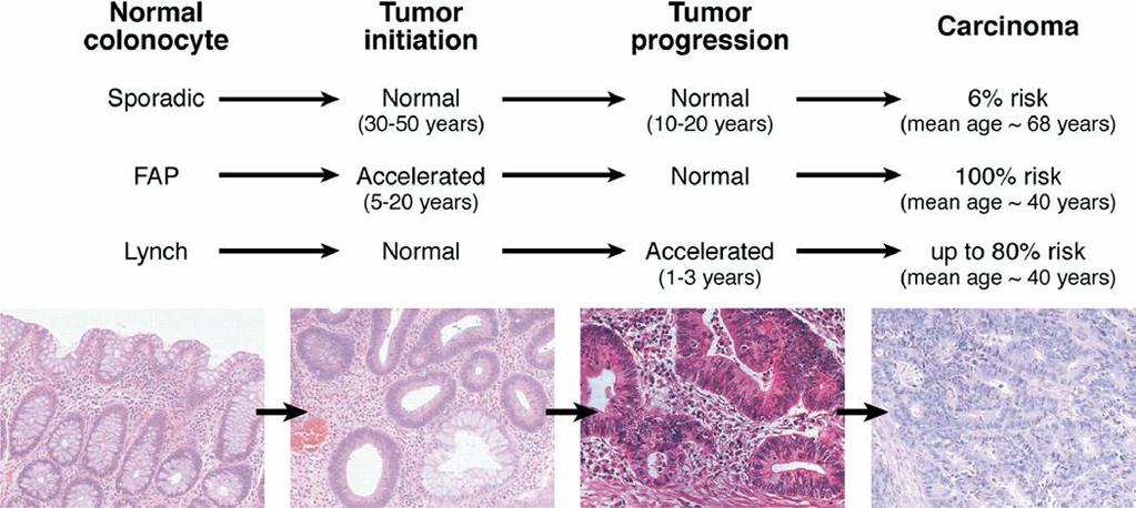 Colorectal cancer progression in sporadic and high risk genetic syndromes Grady W.M.