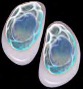 Chemokines *Effects of IL-17A on osteoblast/osteoclast
