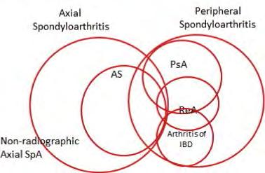 A spondyloarthritisek spektruma axiális spondyloarthritisek perifériás spondyloarthritisek SPA AP