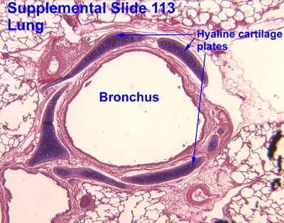 ) Bronchus: Bronchiolus: