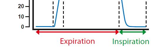 Egyetlen kilégzés CO 2 analízise Phase I is characteristic of the airways, phase II indicates transitional gas, while phase