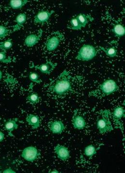 A sejttenyésztő rémálma Befertőződés Kémiai anyagok által (lejárt médium) Biológiai ágensek: baktériumok, gomba (mycoplasmatesztek, alkohol, szájmaszk) Médiumban indikátor: fenolvörös: metabolikus