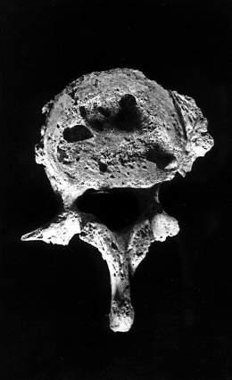 (PALFI et al.