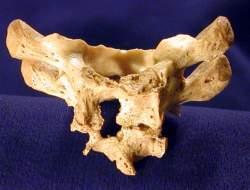 Evidence of MTB DNA