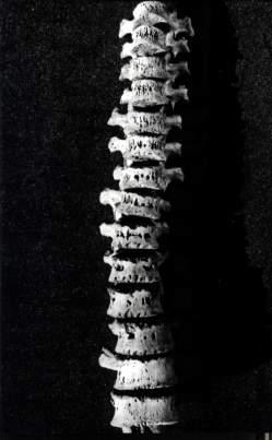 Medieval case, Switzerland (SCHULTZ, 1999)