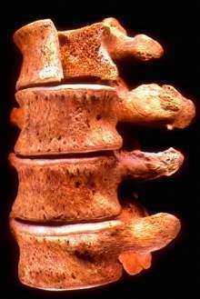 tuberculosis complex DNA
