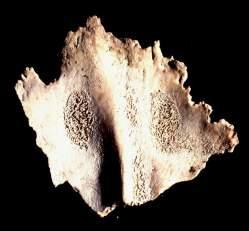 , 2000, PALFI et al.