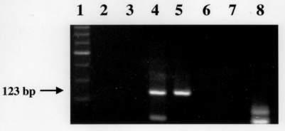 Paleoepidemiology of TB a trilateral research project (1999-2004)