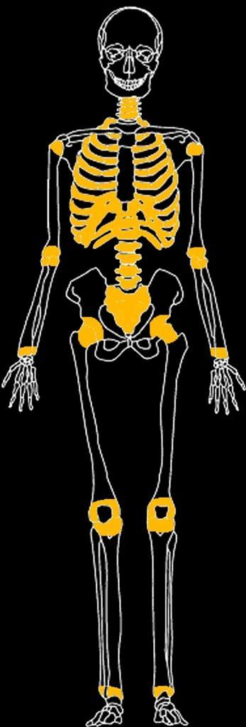 PALEOPATHOLOGICAL RESULTS*