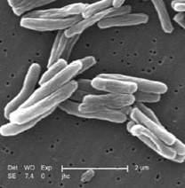 Mycobacteriális fertőzések