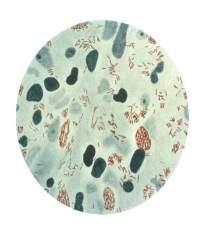 tuberculosis, M. bovis, M.
