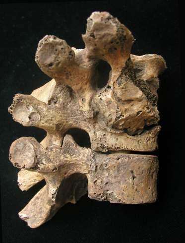 Humán
