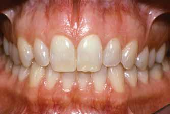 A fogak a felső és az alsó fogsorban találhatók. A felső, valamint az alsó fogmedernyúlványban (processus alveolaris) ívnek megfelelően rendeződnek (arcus dentalis sup.